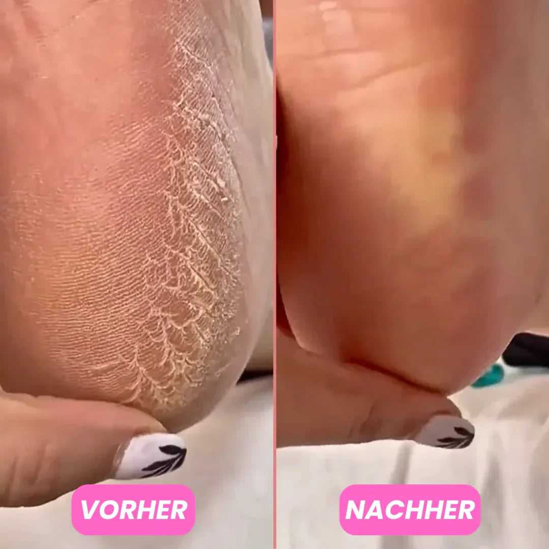 Pflegender Fussbalsam