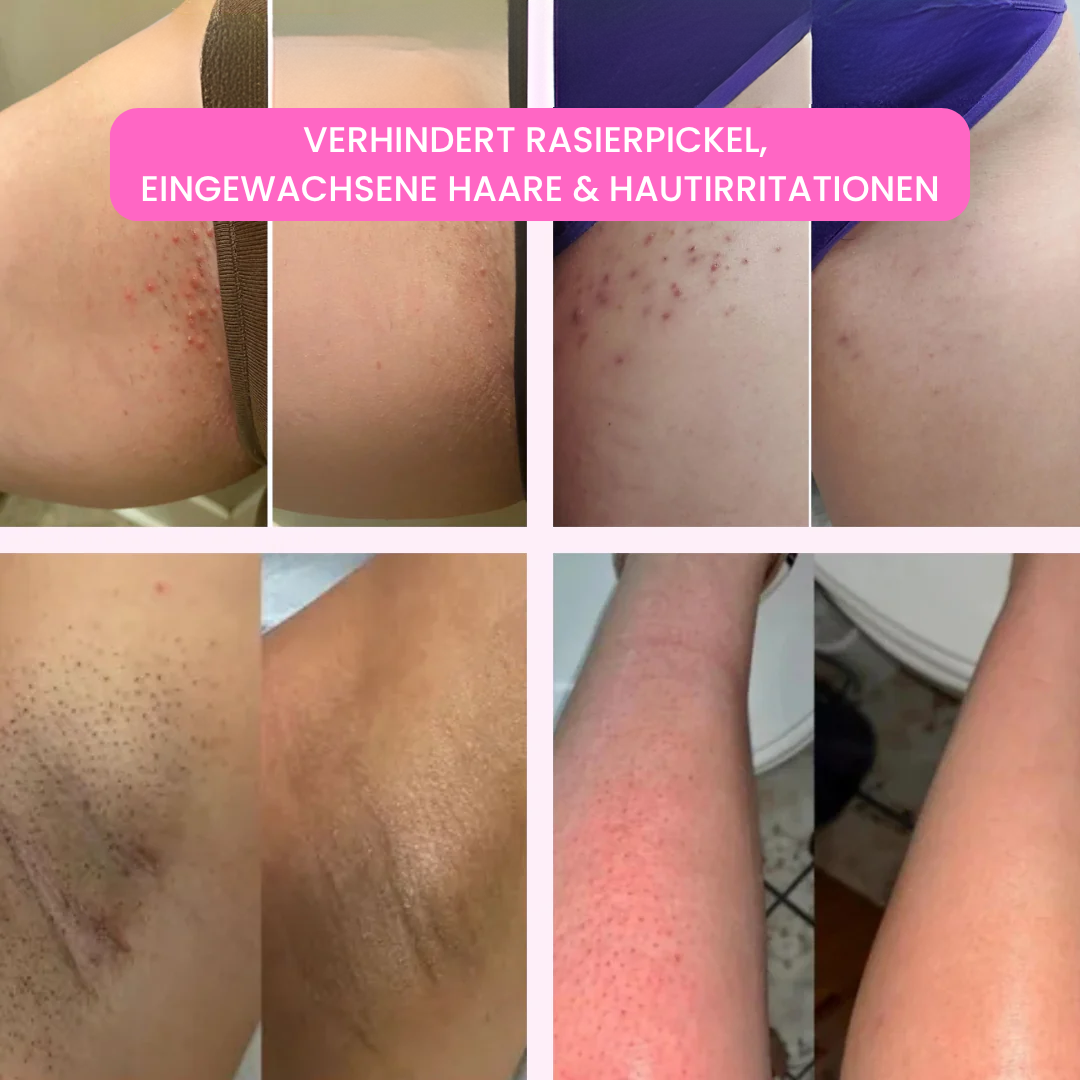 SmoothShave Rasierer 2.0