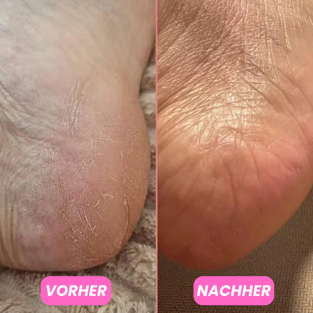 Feuchtigkeitsspendender Fussbalsam