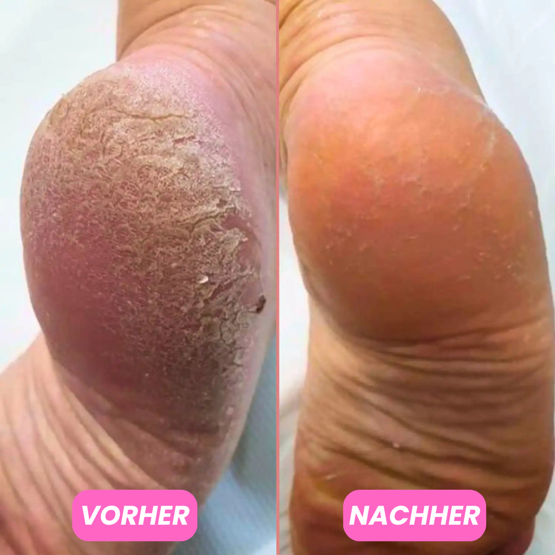 Feuchtigkeitsspendender Fussbalsam