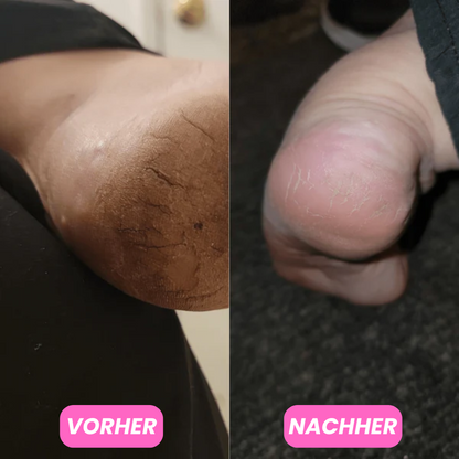 Feuchtigkeitsspendender Fussbalsam