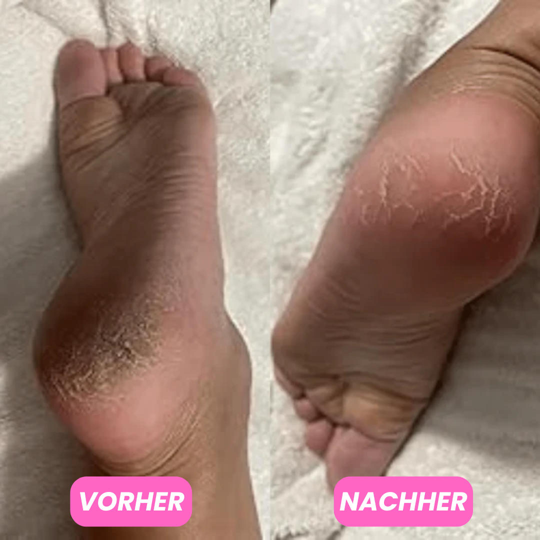 Feuchtigkeitsspendender Fussbalsam