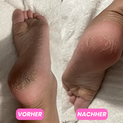 Feuchtigkeitsspendender Fussbalsam
