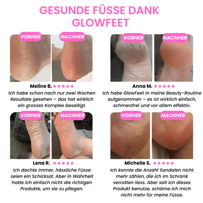 GlowFeet™ – Schönheitskit für Füsse