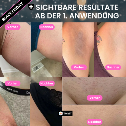 2-in-1 Intimrasierer für empfindliche Haut